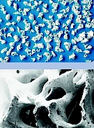 Abb. 3: BioOss® Spongiosa (oben, Granulat 1–2 mm) und Rasterelektronenmikroskopie (unten).