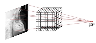 Abb. 2: Bei der 3D-Rekonstruktion aus den vielen, zirkulär um das Objekt angeordneten Projektionsaufnahmen, verwendet man das Prinzip der „Rückprojektion“. Kennt man die geometrische Anordnung für jede einzelne aufgenommene Projektionsaufnahme exakt (und nur dann funktioniert die D-Rekonstruktion), dann kann man die  Strahlen von der Röntgenquelle durch das virtuelle Voxelgitter zurückverfolgen.  Rückprojektion bedeutet dann, dass man den gemessenen Intensitätswert (Grauwert) auf dem entsprechenden Detektor-Pixel sozusagen durch die von diesem Röntgenpfad getroffenen Voxel zurück in Richtung Röntgenquelle „verschmiert“. Macht man dies für sehr sehr viele Projektionsaufnahmen, erhält man für jedes Voxel einen Mittelwert, der ungefähr dem Absorptionswert der in diesem Voxel abgebildeten Struktur entspricht.